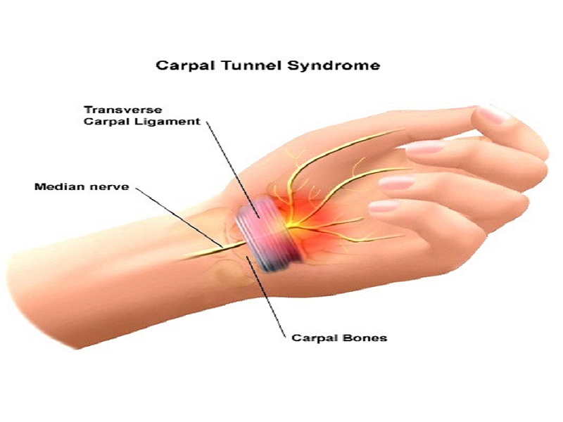 Kako prepoznati simptome i spriječiti bolesti ruke i šake