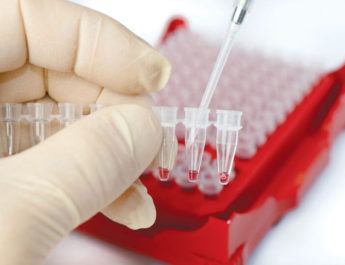 Pročitajte pravilno laboratorijsku analizu krvne slike
