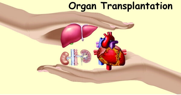 Krađa organa ili doniranje